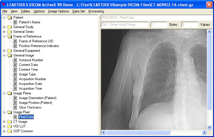 Screenshot of LEADTOOLS Medical SDK