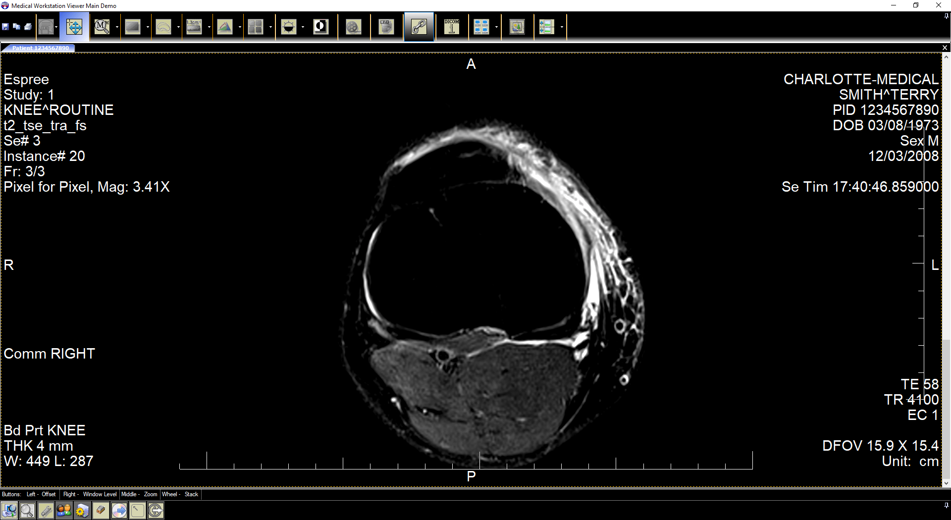 View DICOM ImagesExplore a feature-rich client workstation for viewing DICOM images.