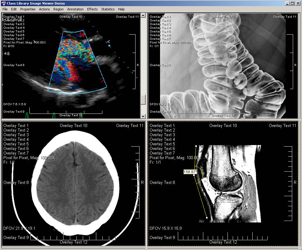 Display DICOM studies and series in one powerful viewer.