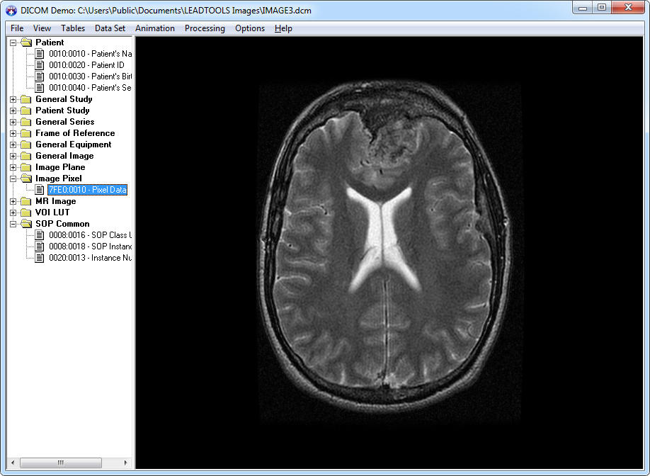 Comprehensive DICOM Data Set support for any application.