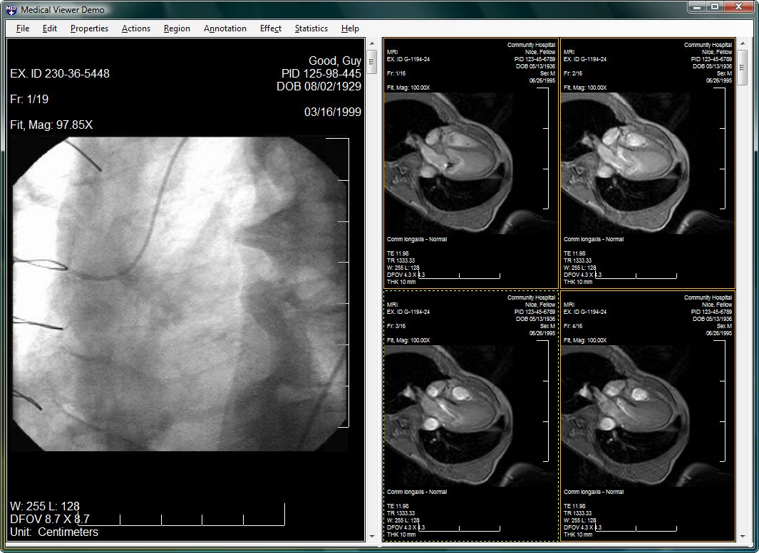 LEADTOOLS PACS Imaging SDK