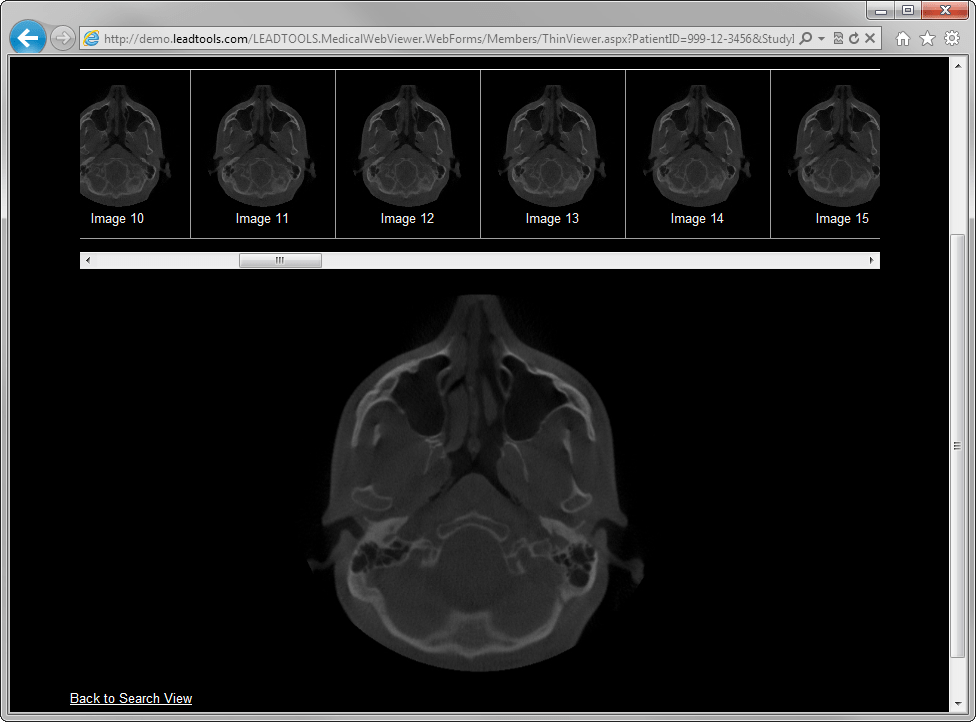 LEADTOOLS Medical HTML5 Module