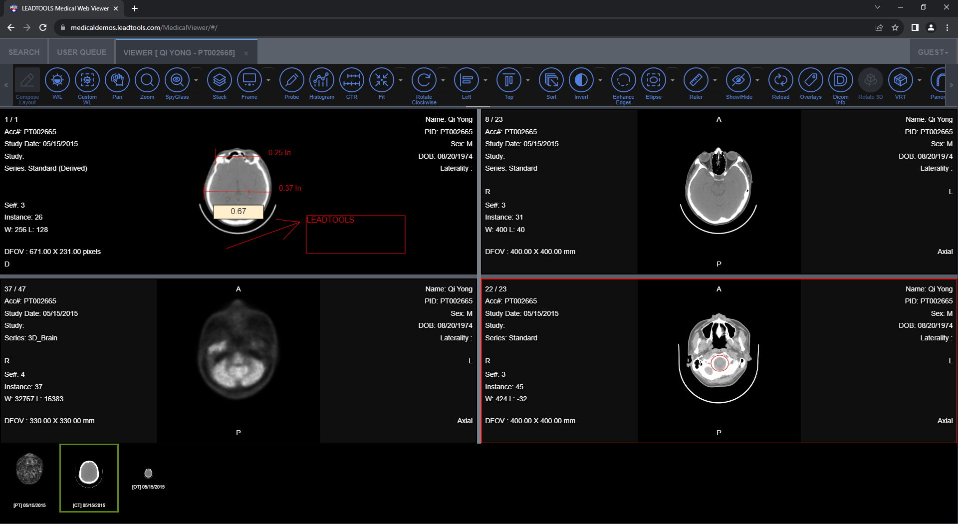 View and Annotate DICOM ImagesView and annotate DICOM images in the browser, alongside full communication with the LEADTOOLS medical services.